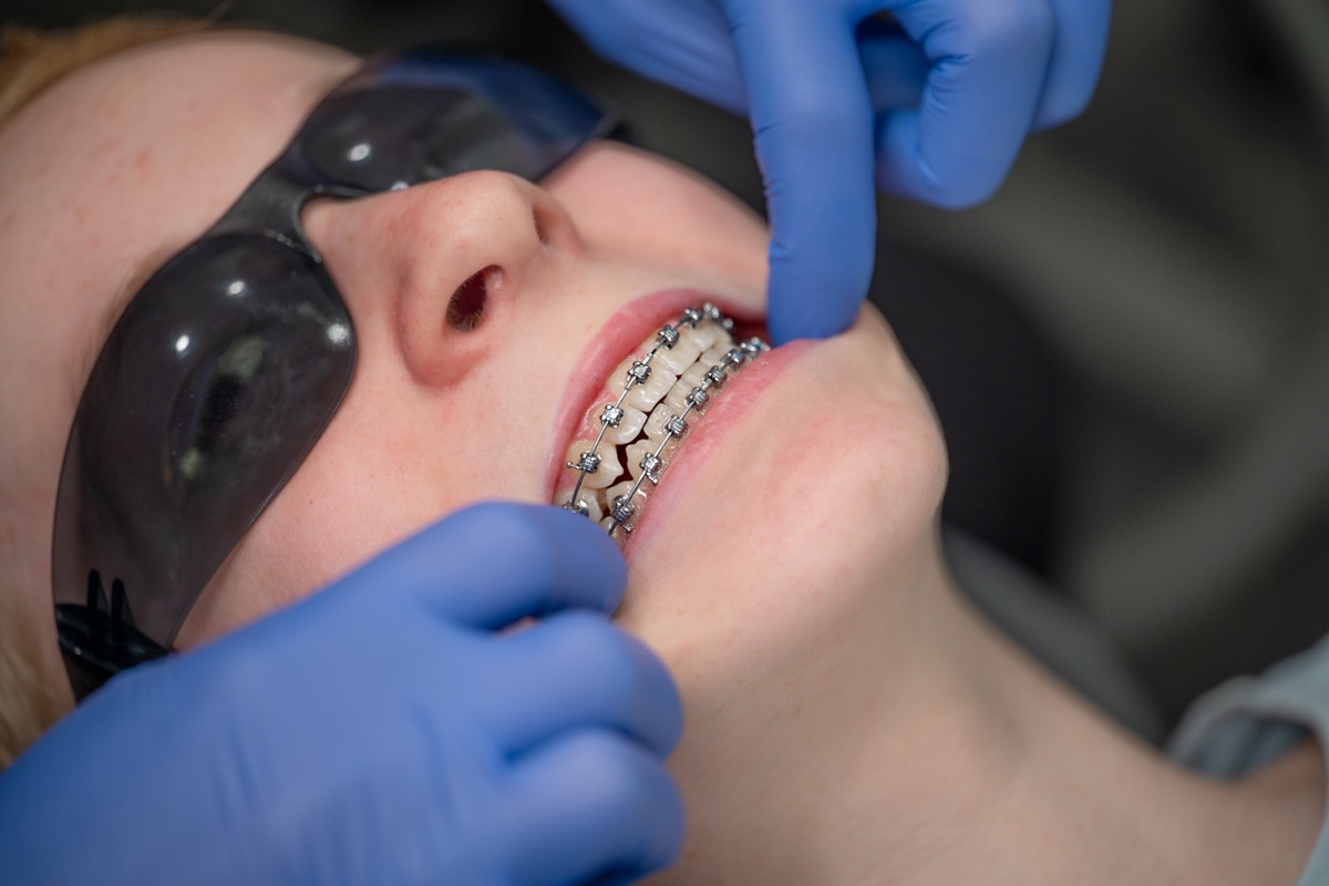 During Treatment