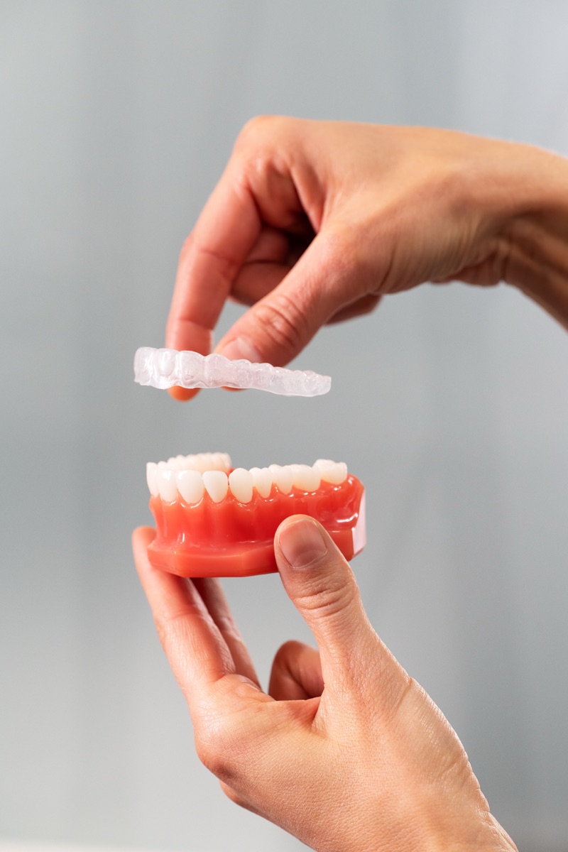 Placing a clear retainer onto a model of the lower teeth